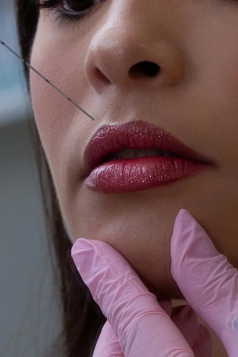 Clínica de preenchimento facial