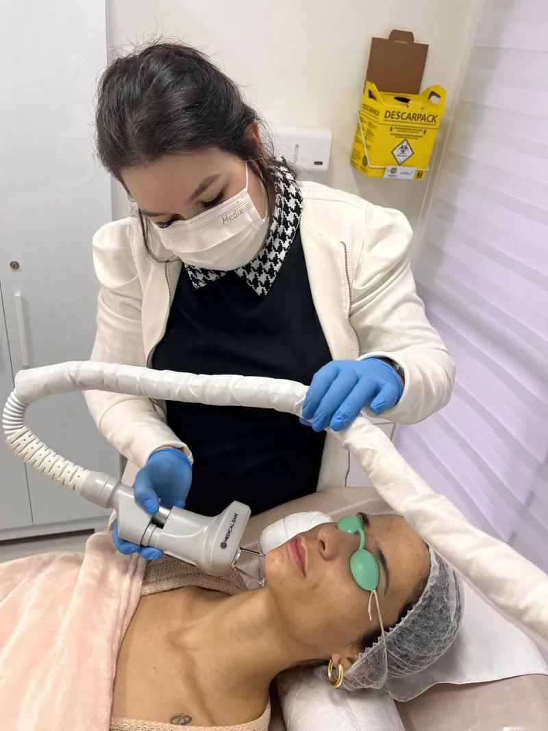 Laser facial no Butantã