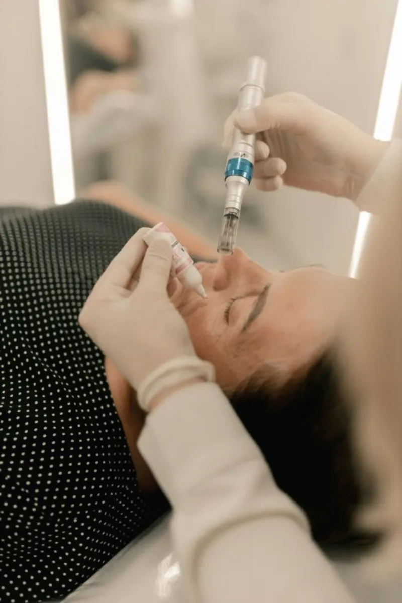 Microagulhamento facial