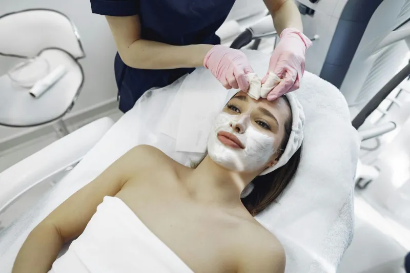 Peeling facial para acne