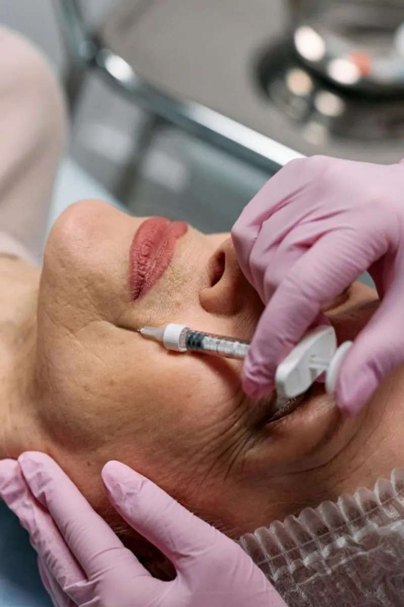 Preenchimento facial com ácido hialurônico
