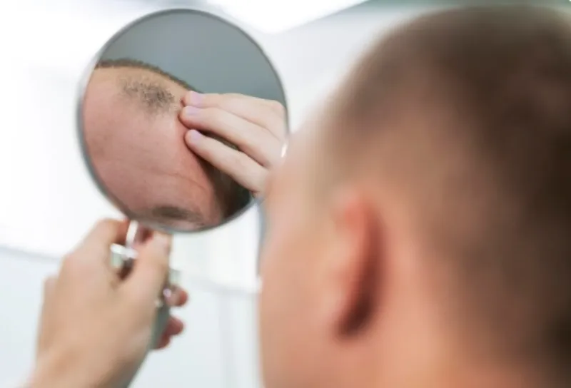 Tratamento capilar masculino