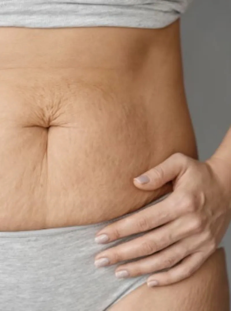 Ultrassom microfocado na barriga