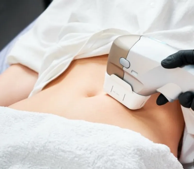 Ultrassom microfocado hifu